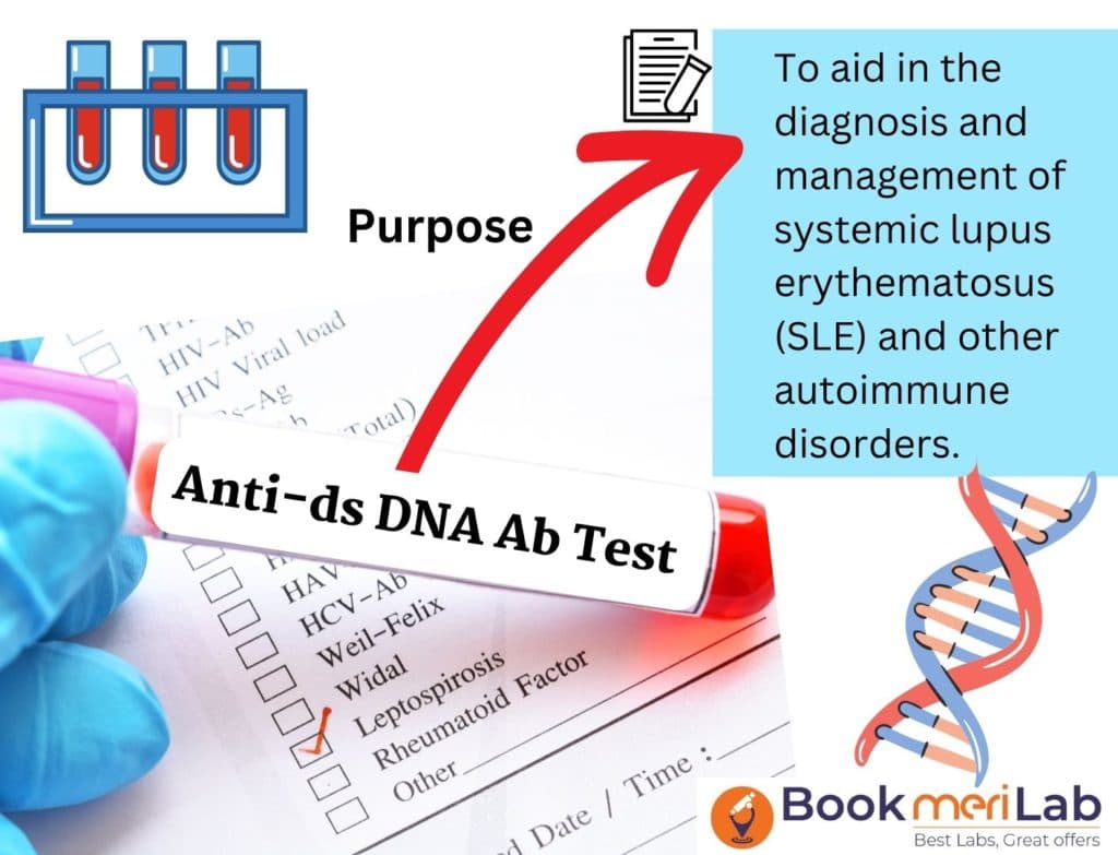 Anti dsDNA Test: Get Price, Purpose, Results & Sample Report [2026]