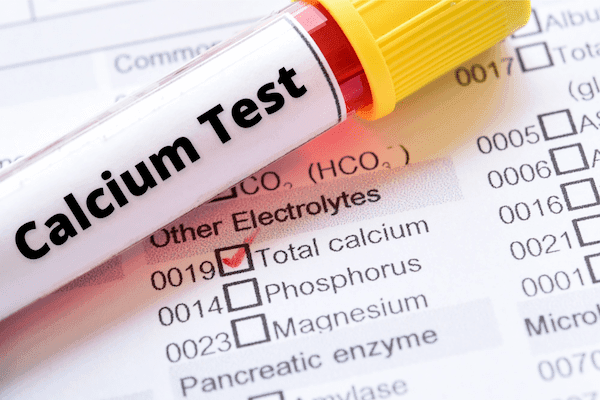 Calcium Test: Price, Purpose, Results, & More [2026]
