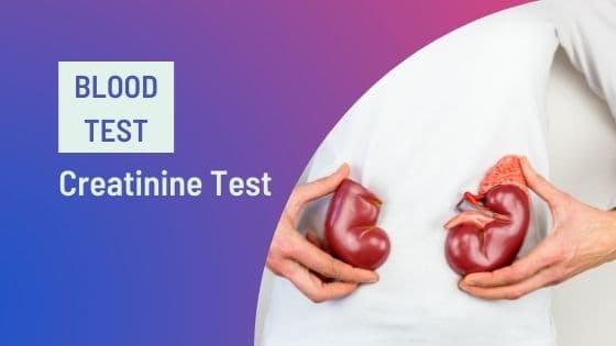Creatinine Test: Purpose, Normal Range & Cost [2026]