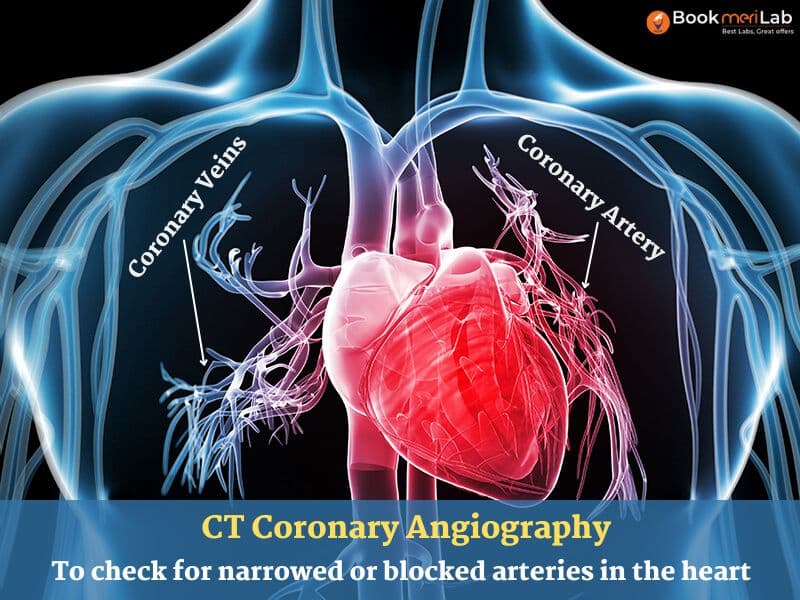 CT Coronary Angiography: Purpose, Procedure, Report & Price [2026]