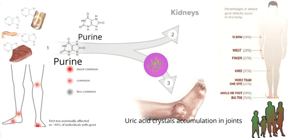 Uric Acid Test Price, Purpose, Range & Result [2026]