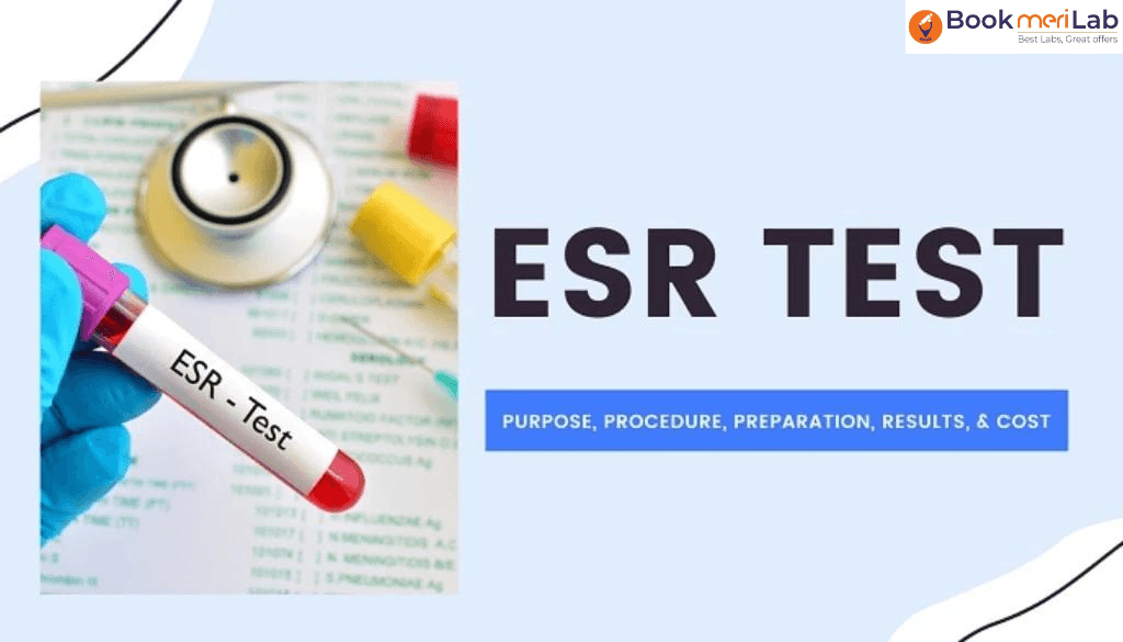 ESR Test: Price, Normal Range, Procedure, Risk, Results [2026]