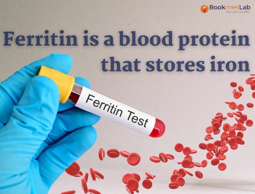 Ferritin Test Price, Purpose, Result & Range [2026]