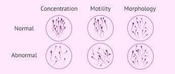 Semen Analysis Test Price, Normal Range & Procedure [2026]
