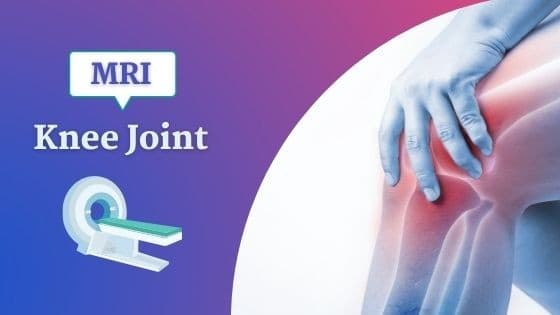 घुटने की एमआरआई लागत, उद्देश्य, प्रक्रिया, जोखिम और परिणाम [2026]
