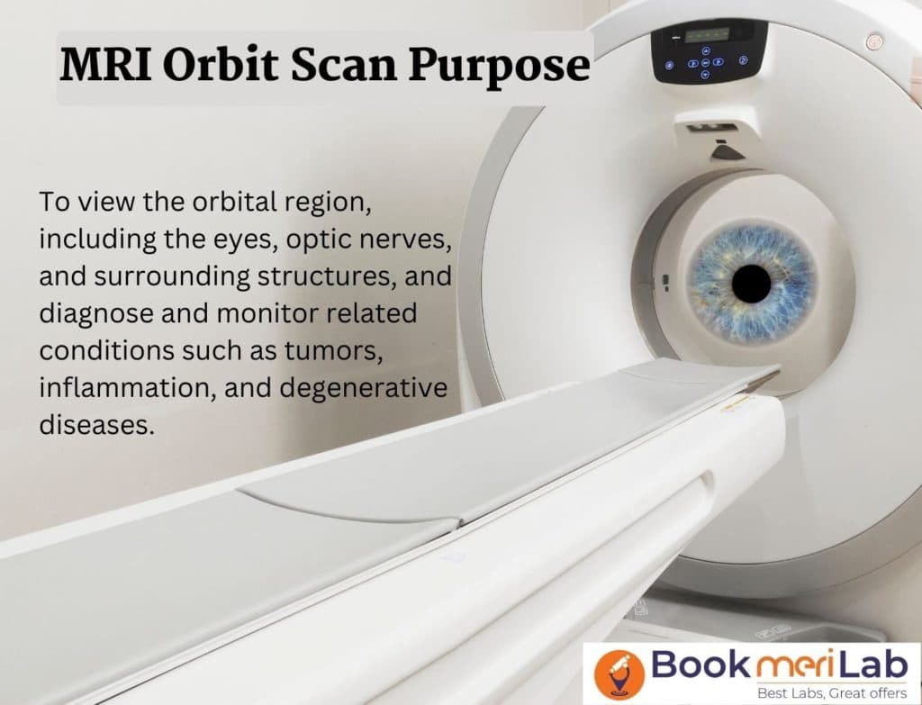 MRI Orbit Scan: Get Price, Purpose, Sample Report & Result [2026]