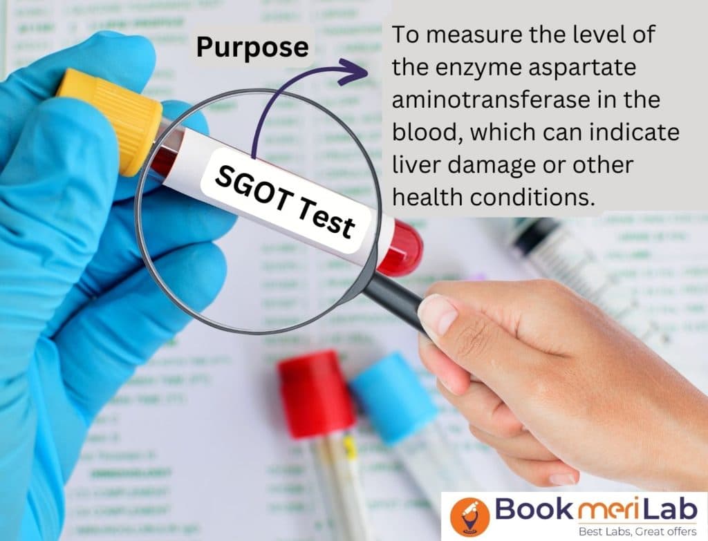SGOT Test: Normal Range, Full Form, Price, Purpose and  Results