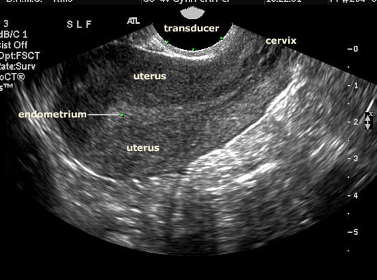 Ultrasound Pelvis Price, Purpose & Results [2026]