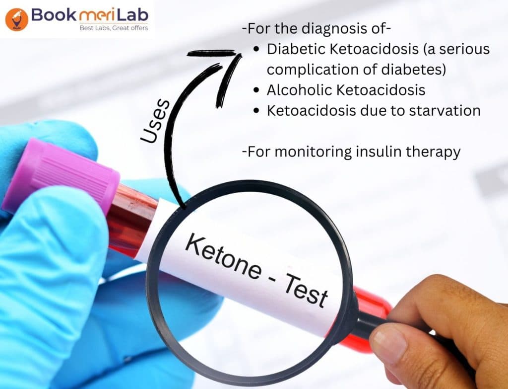 Ketone Test: Price, Purpose, Normal Range & Discount [2026]