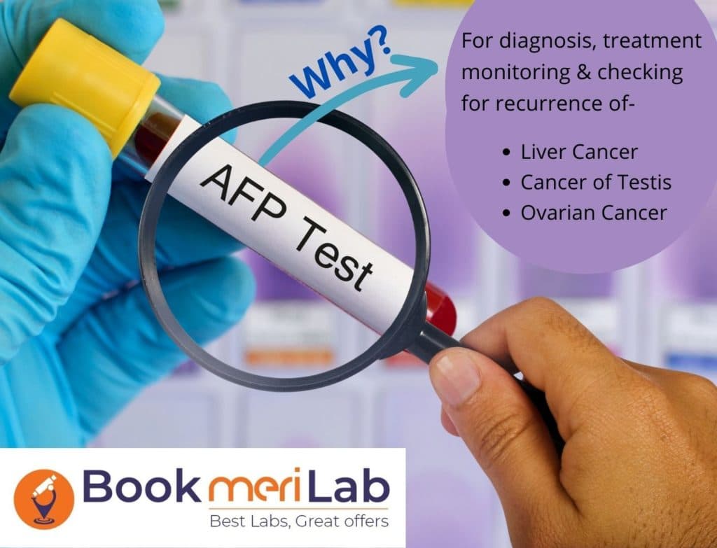 AFP Tumor Marker Test: Price, Purpose, Results & Range [2026]
