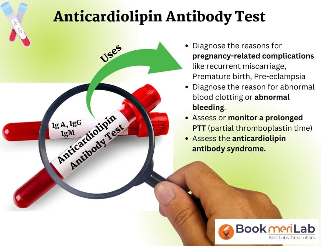 Anticardiolipin Antibody (ACLA) Test – Price, Purpose, Result [2026]