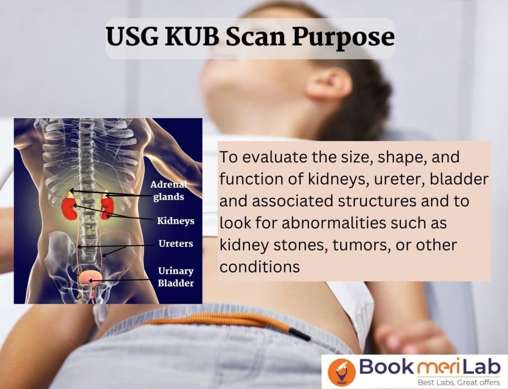 USG KUB Test: Price, Purpose, Procedure, and Result [2026]