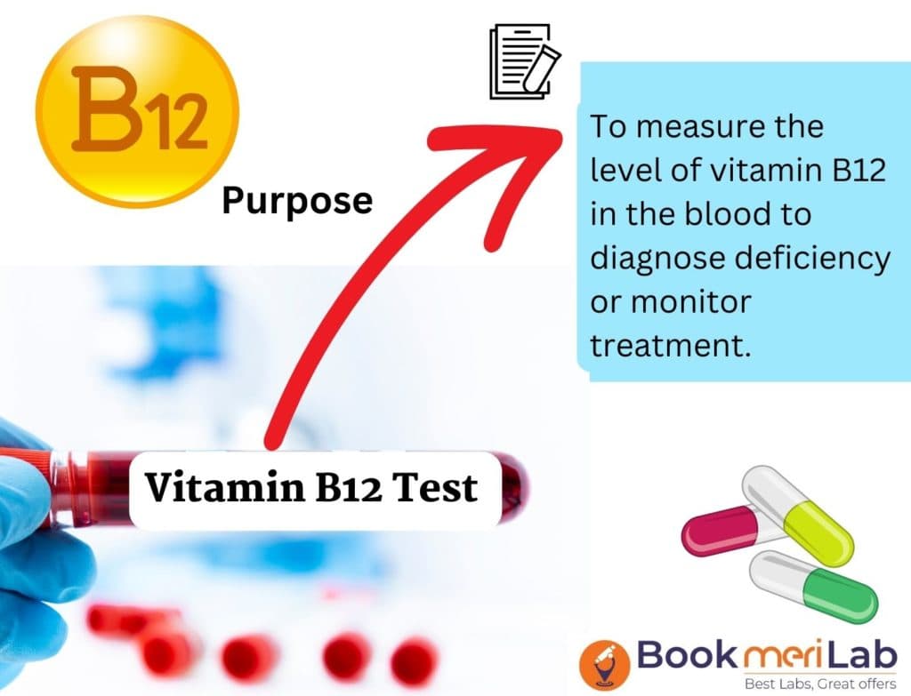 Vitamin B12 Test: Price, Purpose, Results & Normal Range