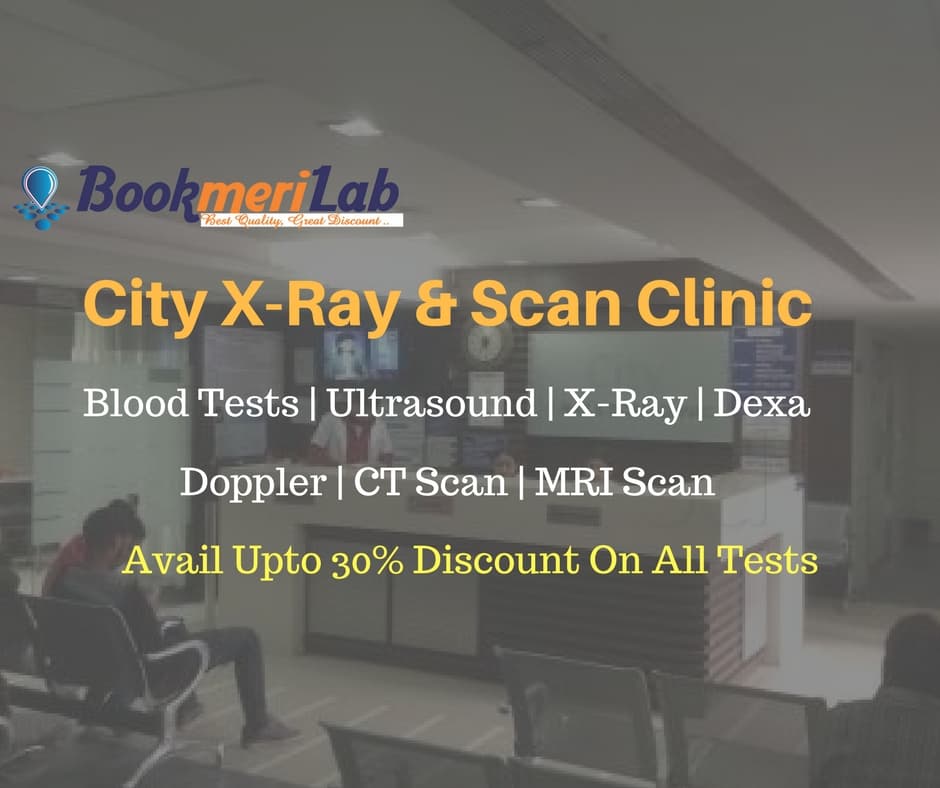 City X-Ray, Delhi | Test Prices & Centres [2026]