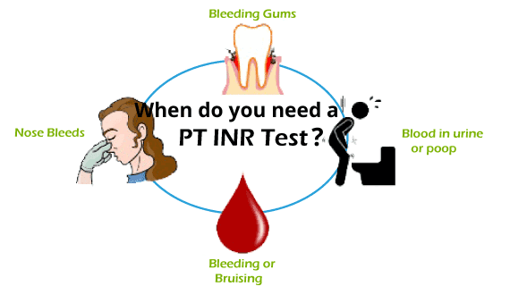 PT INR Test: Price, Purpose, Procedure and Normal Range
