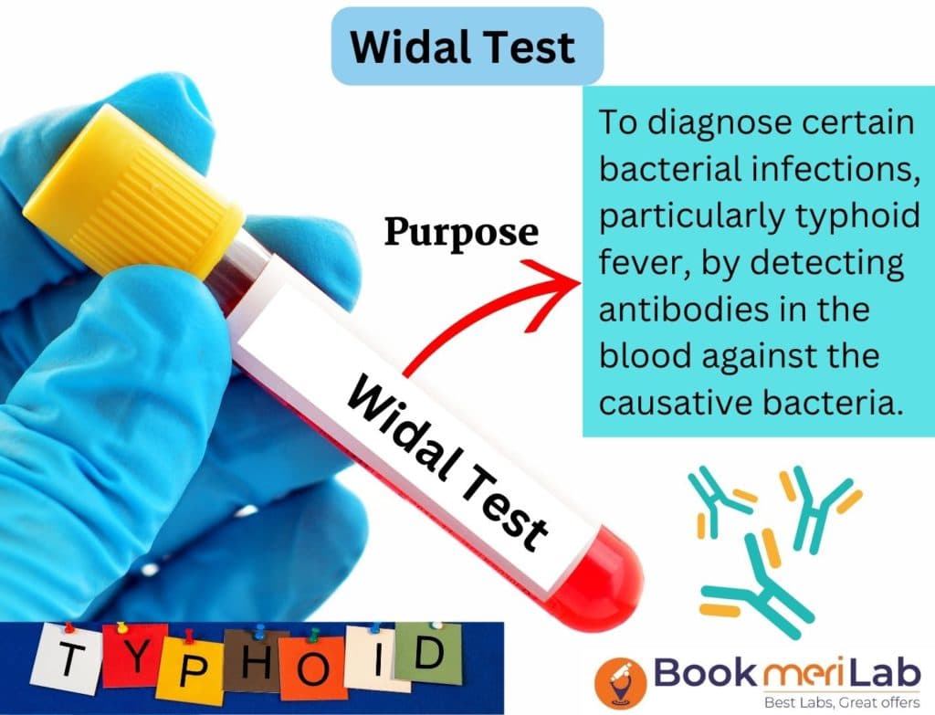 Widal Test- Price, Purpose, Procedure, Results [2026]