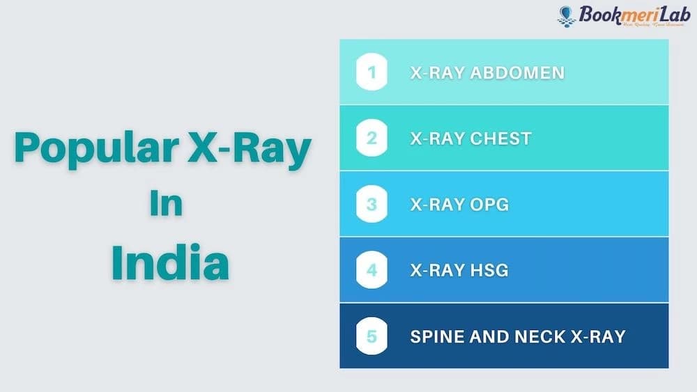 X-Ray Prices in Mumbai With Centres List & Discount [2026]