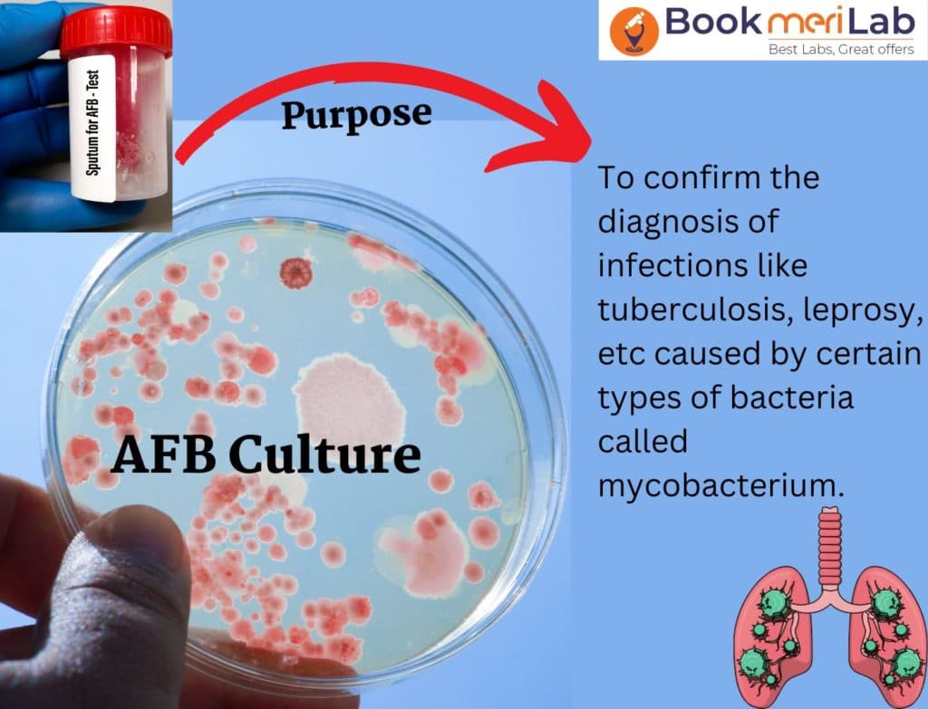 AFB Culture Test – Price, Purpose, Results & more!