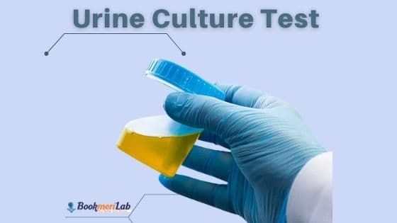 Urine Culture Test: Price, Result, Need, and Normal Range