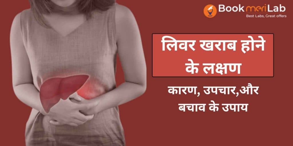 जानिये लिवर खराब होने के 10 लक्षण- कारण, उपचार,और बचाव के उपाय