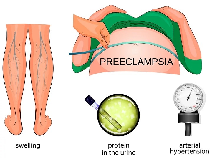 2nd trimester screening tests during pregnancy