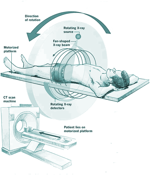 CECT abdomen
