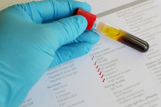 Cardiac Risk Markers