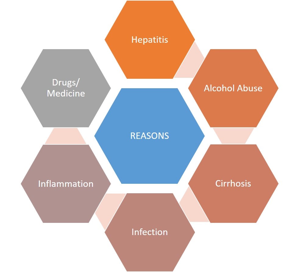 Reasons for Abnormal Level in LFT Test - Liver Function Test