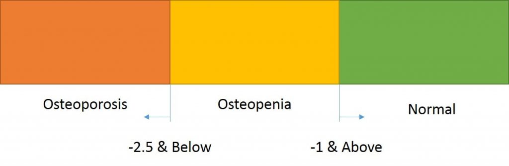 Understanding T-Score of Dexa Scan