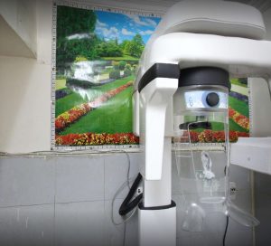 X-Ray OPG Area