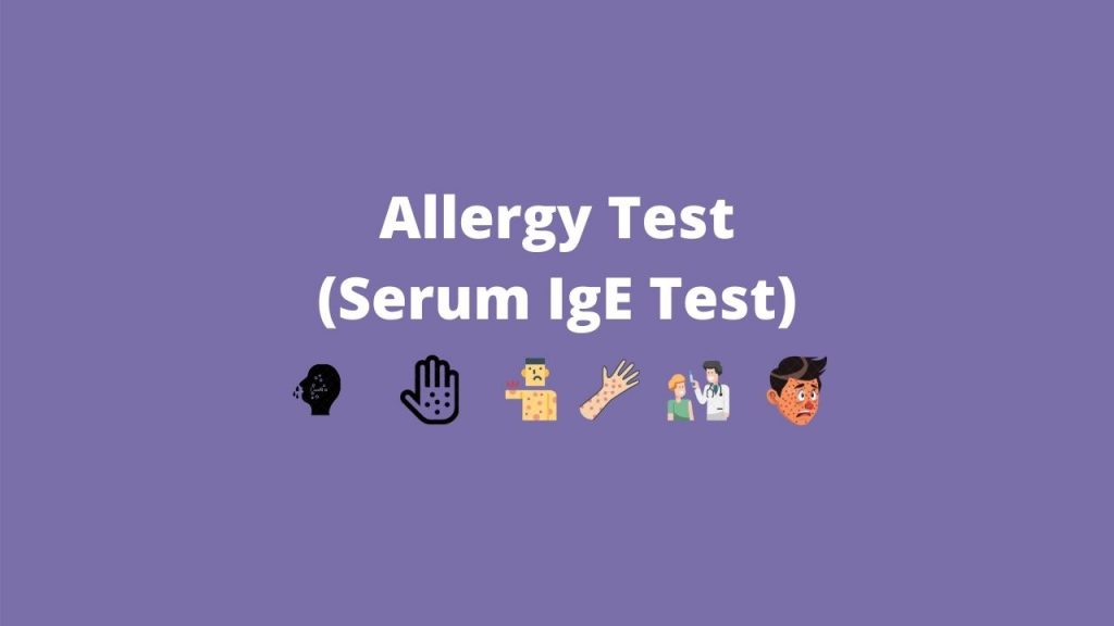 serum ige test