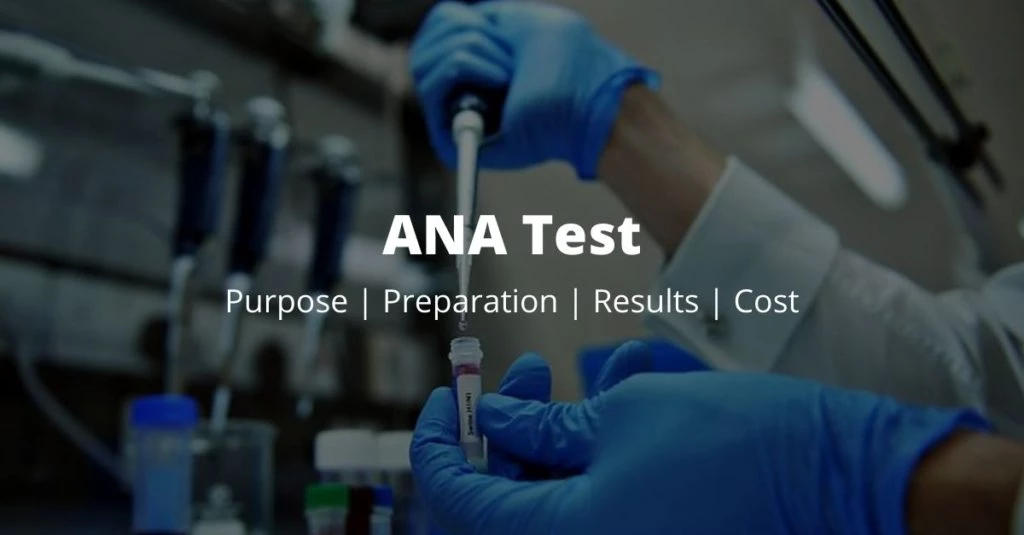 ana test 