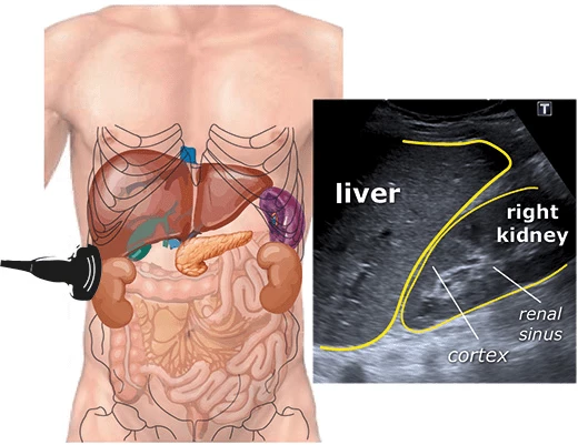 usg whole abdomen image