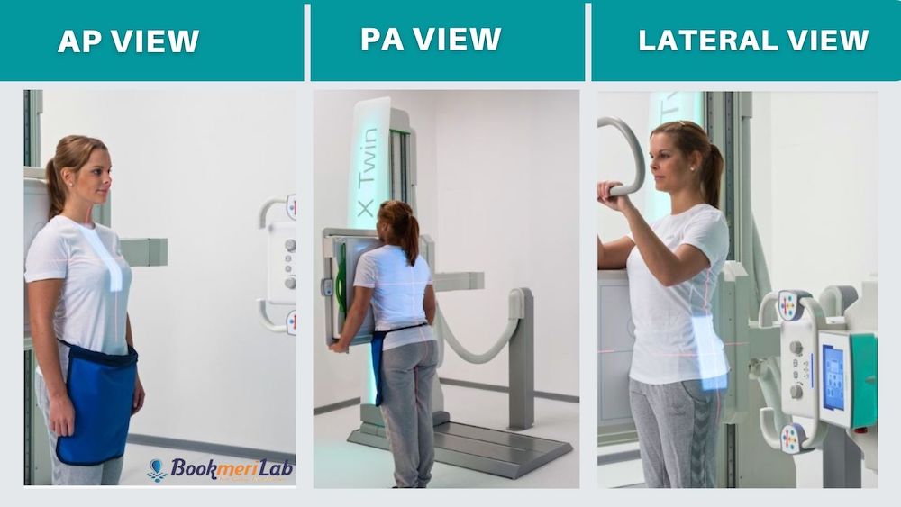 different views in xray