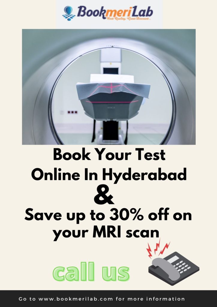 MRI scan cost in Hyderabad