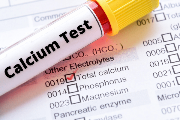 calcium test
