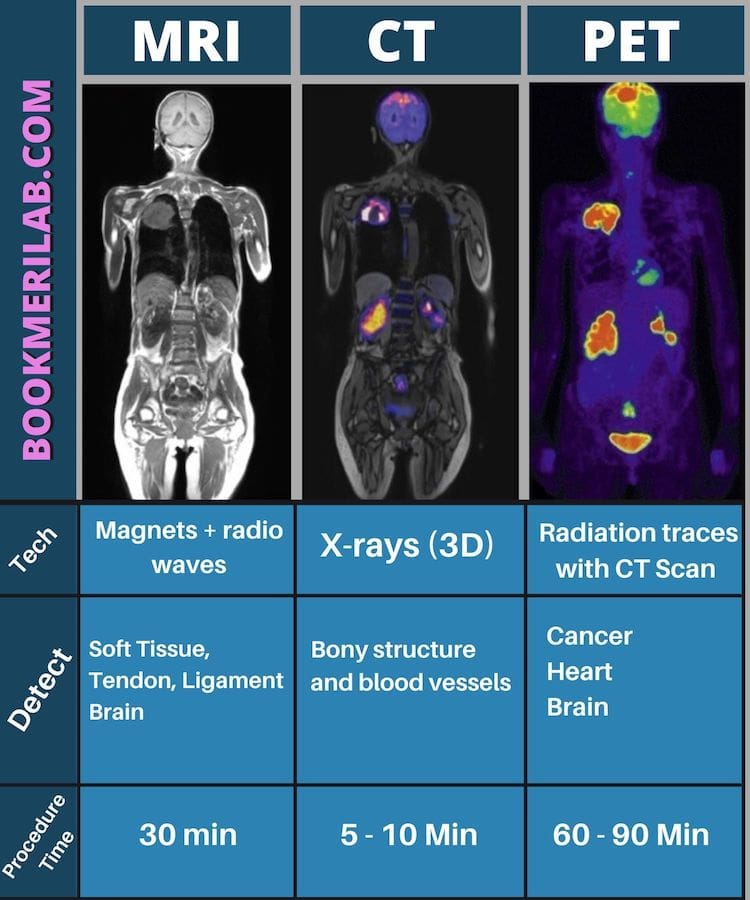 comparison with other MRI and CT scan