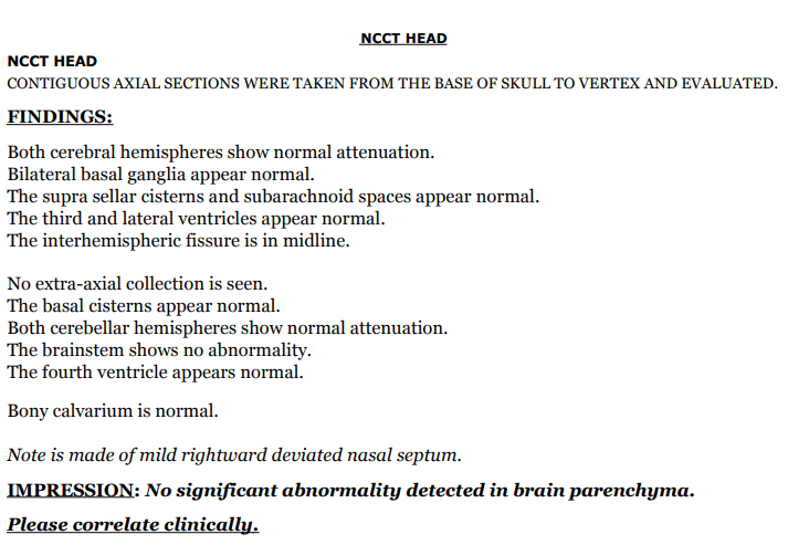 ct scan brain sample report