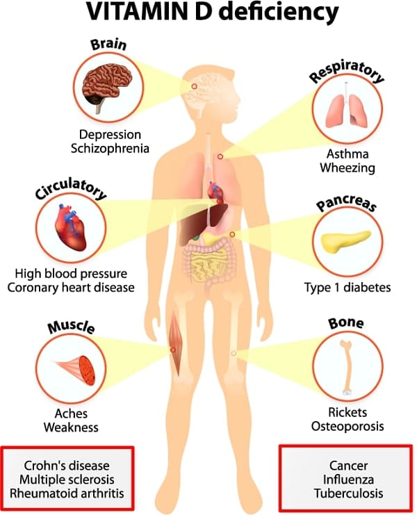 Vitamin D and D3 Deficiency