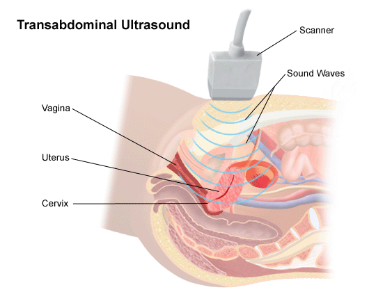 Transrectal ultrasound in men