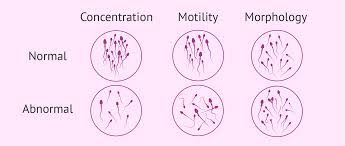 Explanation of normal and abnormal properties of sperms.

