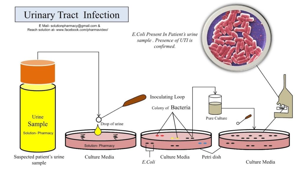 Representation of procedure of Urinary culture.