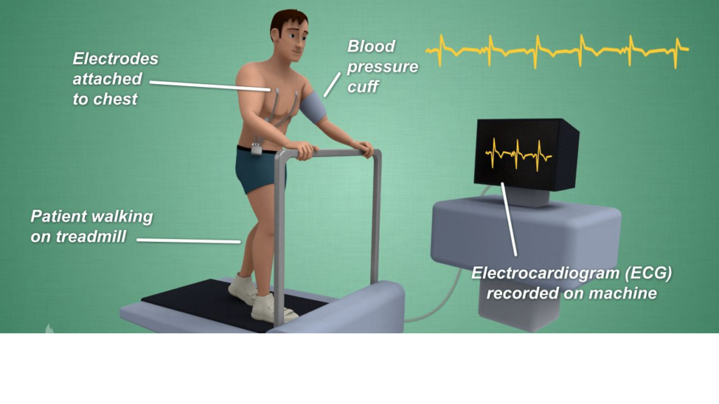 The Treadmill test procedure.