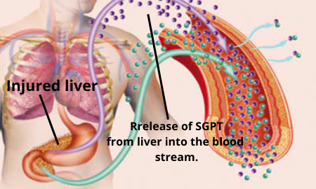 SGPT in blood circulation.