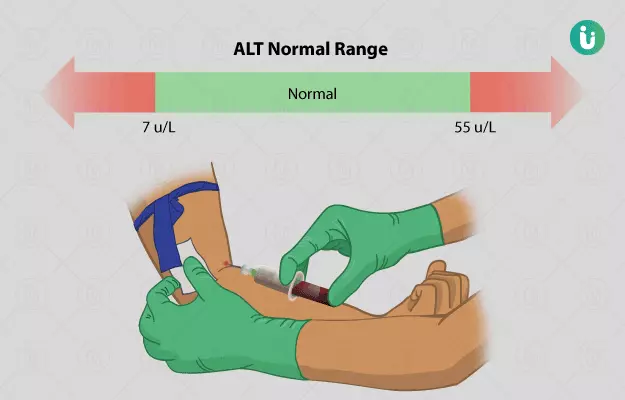 SGPT normal range