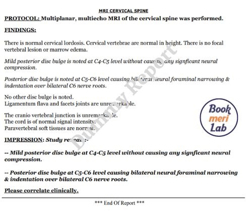 mri cervical spine sample report