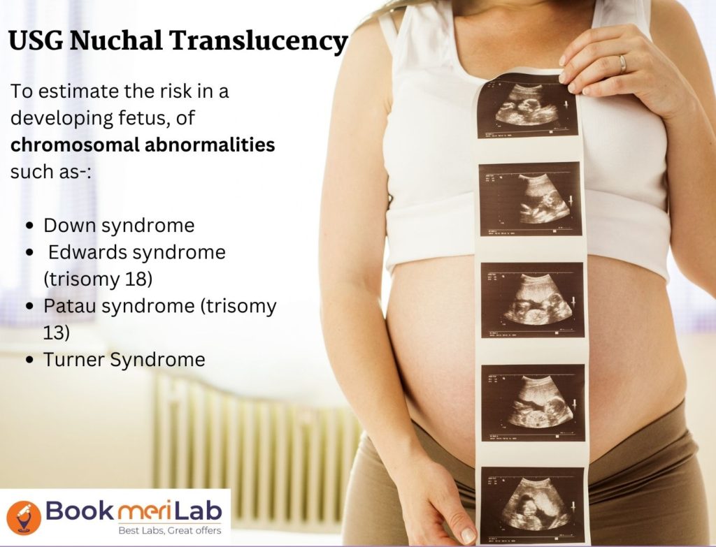 Ultrasound NT Scan Purpose