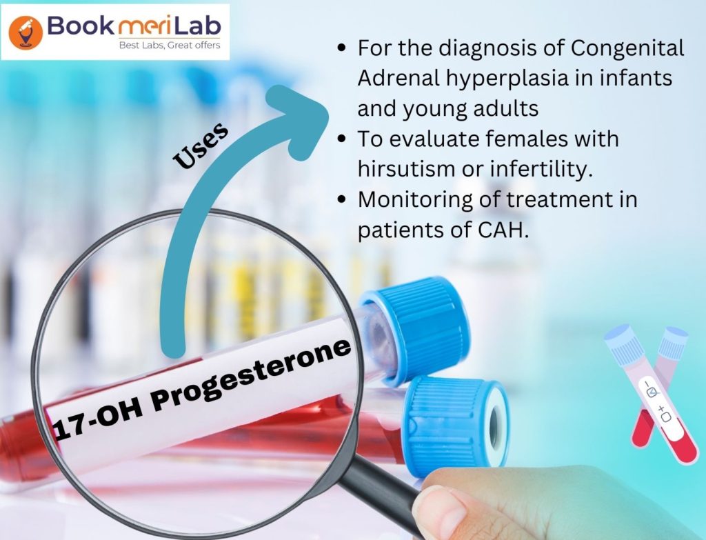 17-OH Progesterone Test Purpose