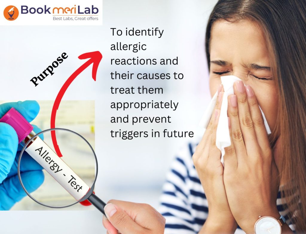 Allergy Test Purpose