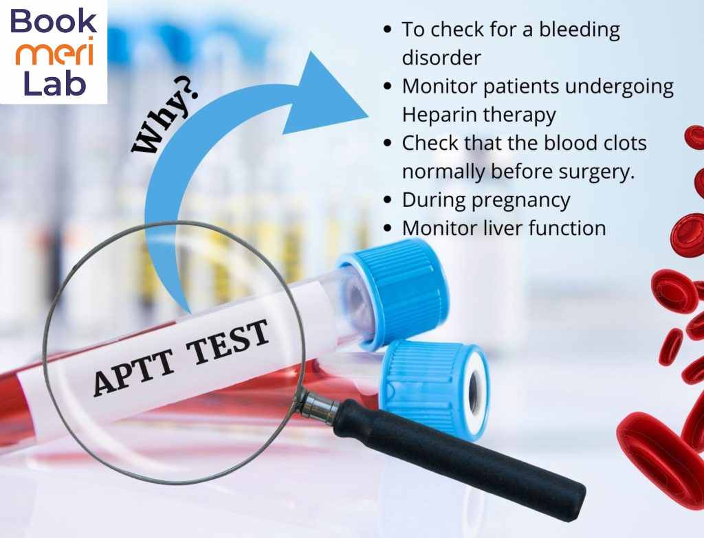 APPT test purpose